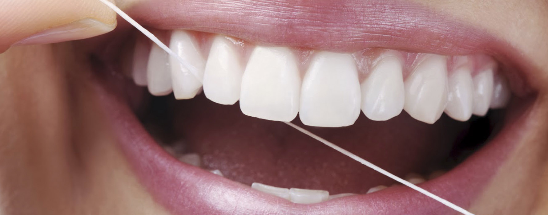 Qual é o dente que está inclinado a fazer alguma coisa? - Charada